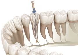 Endodontics